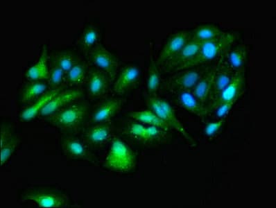 IHC-plus™ Aspartate Aminotransferase Antibody