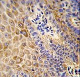 GBA / Glucosidase Beta Acid Antibody (aa337-365)
