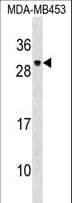Polyclonal Rabbit anti-Human PDF / PLAB Antibody (aa125-151, WB)