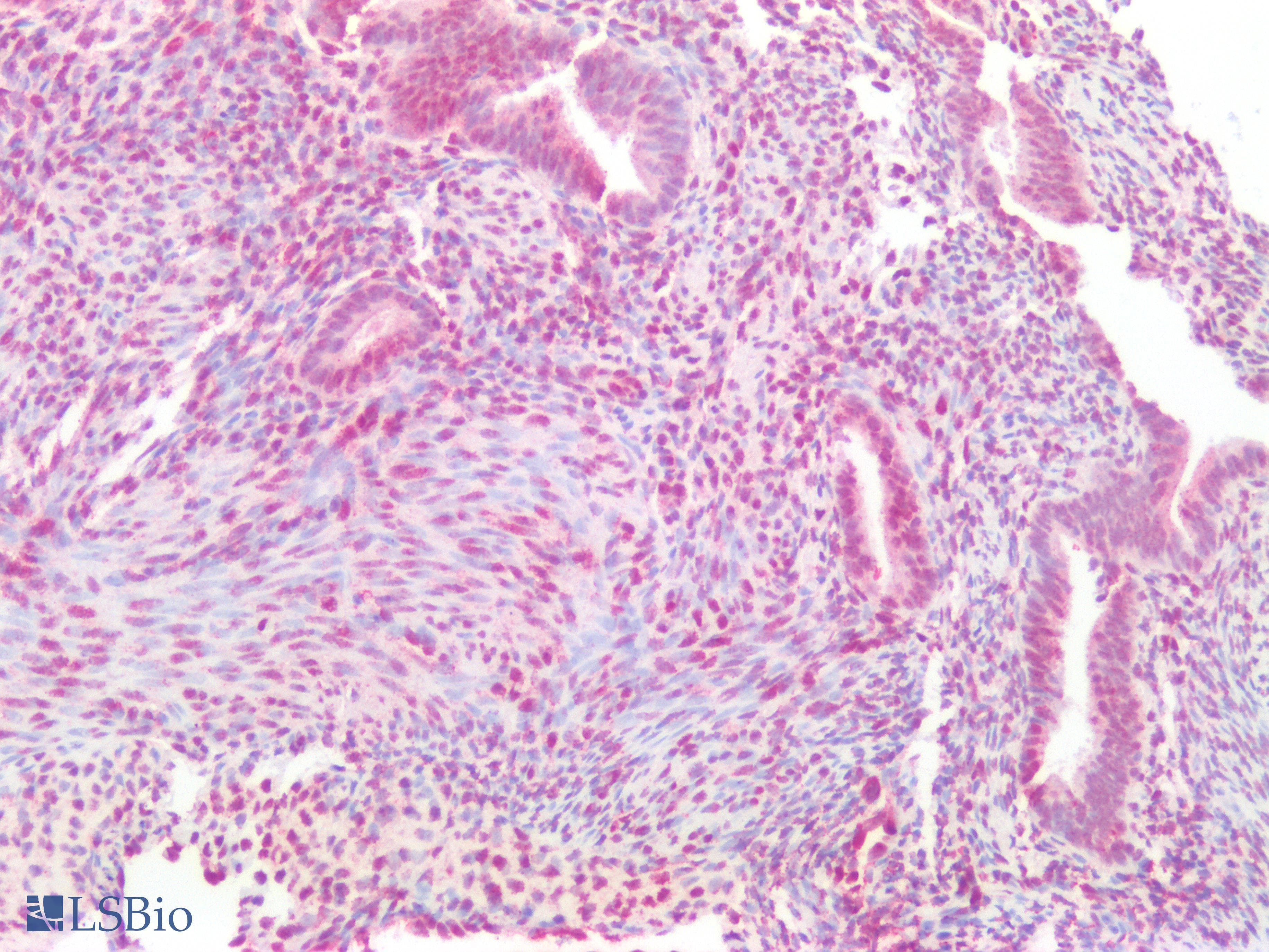 PathPlus™ ERG Antibody (clone 8A9)