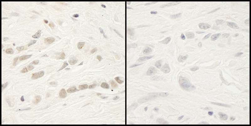 Polyclonal Rabbit anti-Human RELA / NFKB p65 Antibody (phospho-Ser468, IHC)