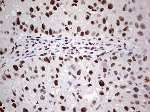 SAE1 Antibody (clone OTI3C3)