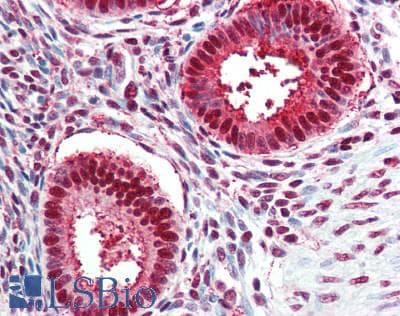 IHC-plus™ TPI1 / TPI Antibody (aa1-50)