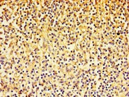 Polyclonal Rabbit anti-Human ADGRE1 / EMR1 Antibody (aa21-290, IHC)