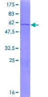 Human SDHB Protein (Recombinant GST)