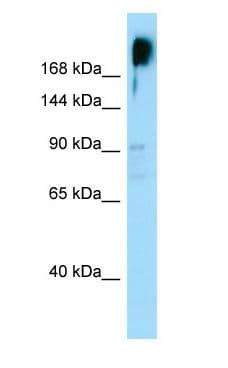 Polyclonal Rabbit anti-Human KNDC1 Antibody (aa962-1011, WB)