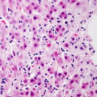 GCGR / Glucagon Receptor Antibody (Internal)
