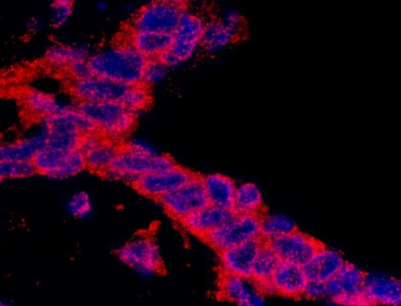 CASC3 / MLN51 Antibody (aa653-703)