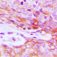Polyclonal Rabbit anti-Human INSR / Insulin Receptor Antibody (C-Terminus, IHC, IF, WB)