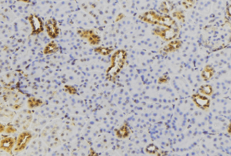 Polyclonal Rabbit anti-Human RAB22A / RAB22 Antibody (IHC, WB)