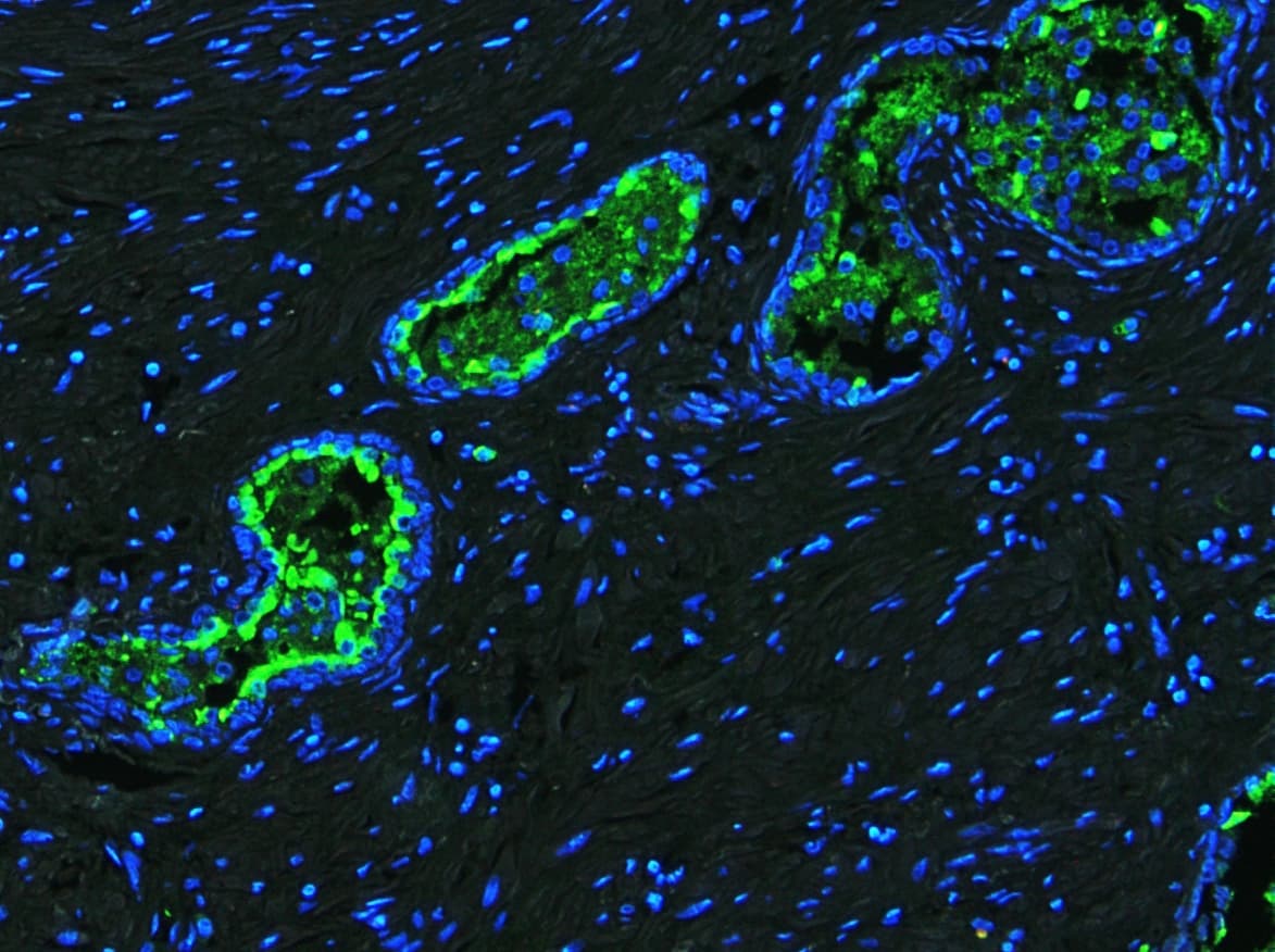 Polyclonal Rabbit anti-Human LF / LTF / Lactoferrin Antibody (IHC, WB)