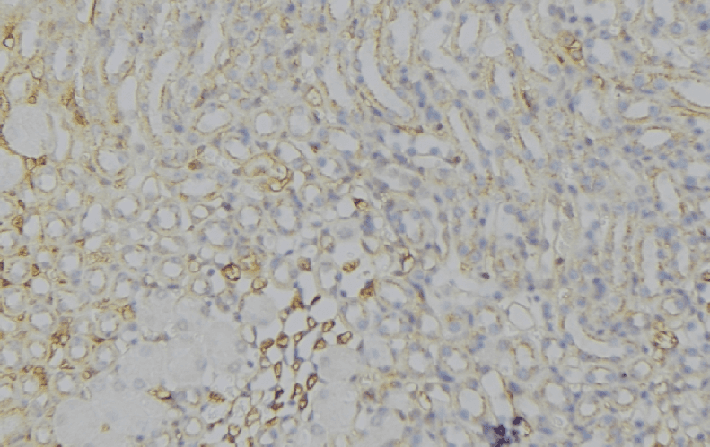 Polyclonal Rabbit anti-Human HMG-CoA Reductase / HMGCR Antibody (IHC, WB)