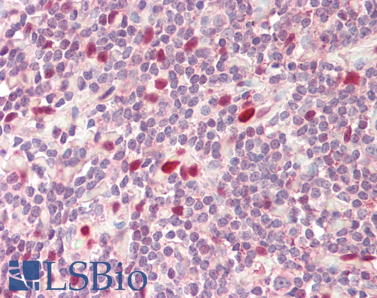 IHC-plus™ Polyclonal Rabbit anti-Human IL-33 Antibody (IHC, WB)