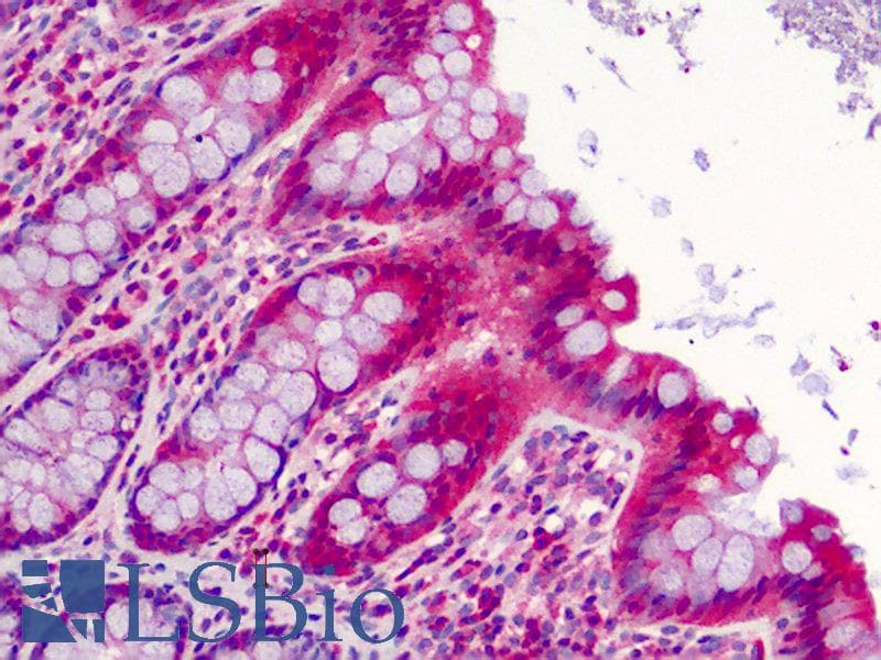 IHC-plus™ Polyclonal Rabbit anti-Human SLFN12 Antibody (IHC, WB)