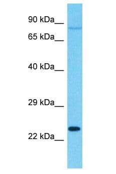SENP8 Antibody (aa101-150)
