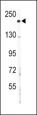 Polyclonal Rabbit anti-Human COL5A2 / Collagen V Alpha 2 Antibody (aa90-118, WB)