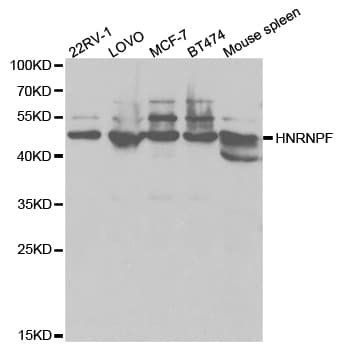 HNRNPF / hnRNP F Antibody