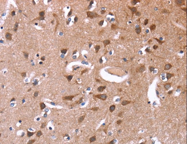 Polyclonal Rabbit anti-Human GREB1 Antibody (IHC)