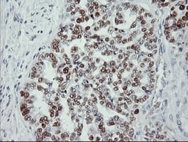 TP53 / p53 Antibody (clone OTI1D11, Carrier-free)