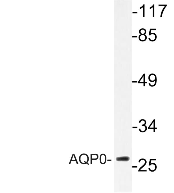 MIP / AQP0 / Aquaporin 0 Antibody (Cys144)
