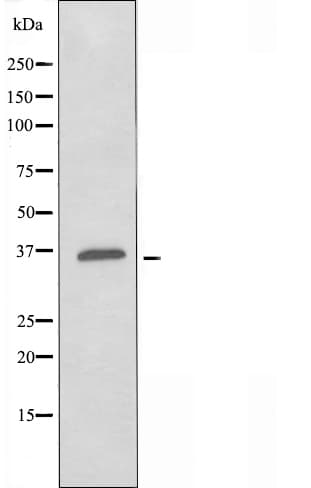 Polyclonal Rabbit anti-Human OR4K14 Antibody (IF, WB)