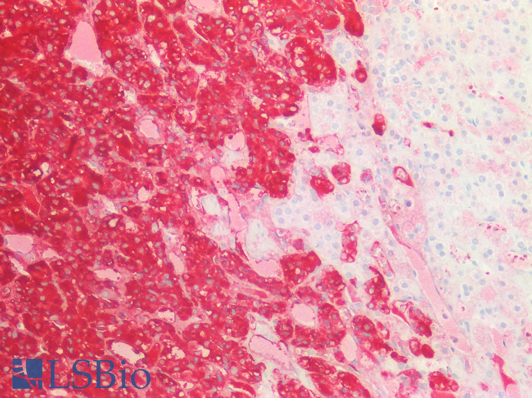 PathPlus™ Monoclonal Mouse anti-Human CHGA / Chromogranin A Antibody (IHC, WB)