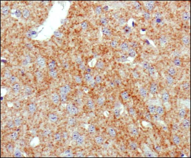 SLC6A3 / Dopamine Transporter Antibody (N-Terminus, clone mAb16)
