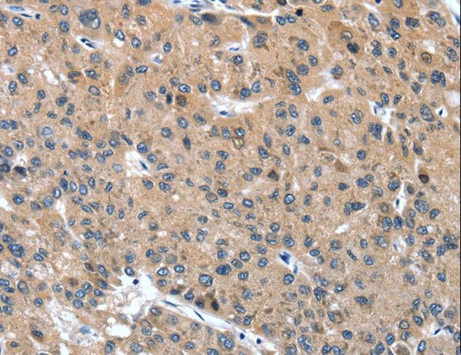 Polyclonal Rabbit anti-Human DSC1 / Desmocollin 1 Antibody (IHC)