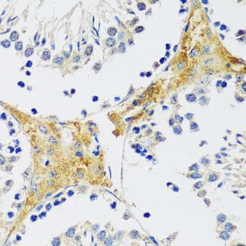 CAMK1 / CAMKI Antibody