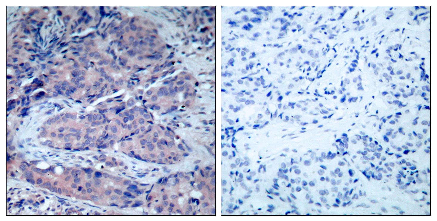 Polyclonal Rabbit anti-Human MAP2K4 / MKK4 Antibody (aa227-276, IHC)