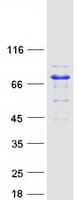 Human AK5 / Adenylate Kinase 5 Protein (Recombinant Myc-DDK (Flag))