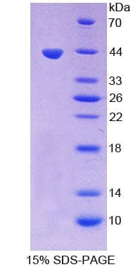 Human HS2ST1 Protein (Recombinant His-T7)