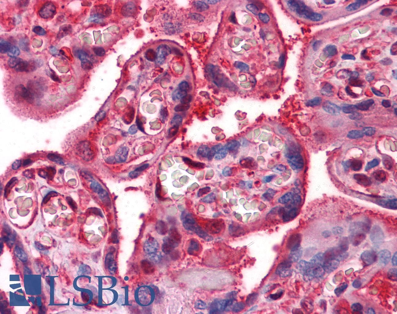 IHC-plus™ Monoclonal Mouse anti-Human CLIC1 / NCC27 Antibody (clone 2D4, IHC, WB)
