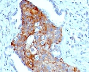 TRIM29 Antibody (N-Terminus, clone TPMP29-1)