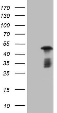 Monoclonal Mouse anti-Human RB1 / Retinoblastoma / RB Antibody (clone OTI3F11, aa309-590, IHC, WB)
