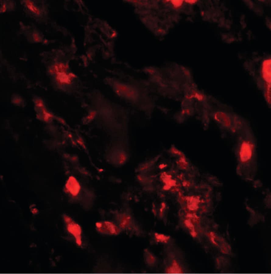 IHC-plus™ IL36B Antibody