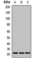 UBE2F Antibody
