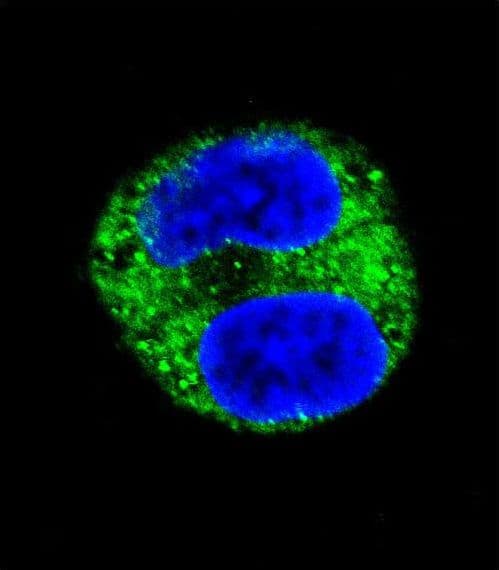 Tyrosinase Antibody (aa176-205)