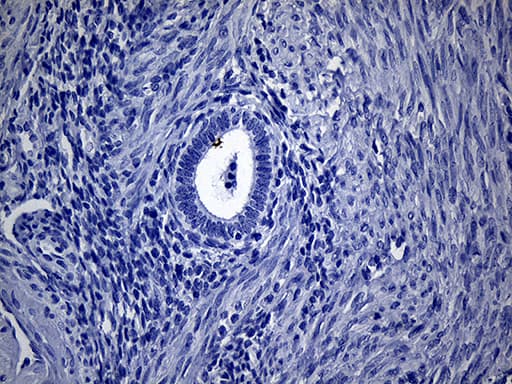 VAX1 Antibody (clone OTI1E6)