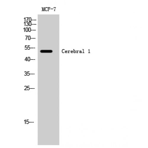 RRP8 Antibody (240-320 aa, Internal)