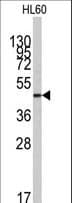 ZIC3 Antibody (aa4-32)