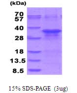 Human ZFAND5 Protein (Recombinant His)