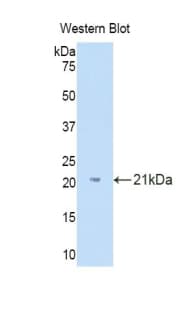 IL18BP Antibody (aa31-194)