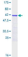 Human SNAP29 Protein (Recombinant GST)