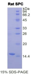 Rat SFTPC / Surfactant Protein C (Recombinant His)