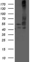 DLD / Diaphorase / E3 Antibody (clone OTI8A10, Carrier-free)