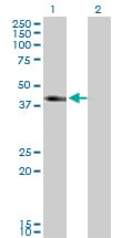 Monoclonal Mouse anti-Human SLC12A1 / NKCC2 Antibody (clone 4H4, WB)