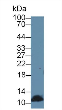DBI / ACBD1 Antibody (aa2-87)