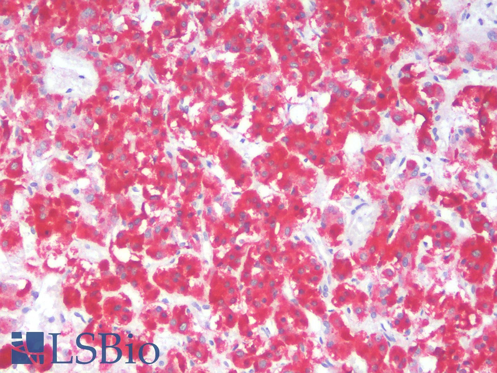 PathPlus™ Polyclonal Rabbit anti-Human PIK3CA / PI3K Alpha Antibody (IHC)