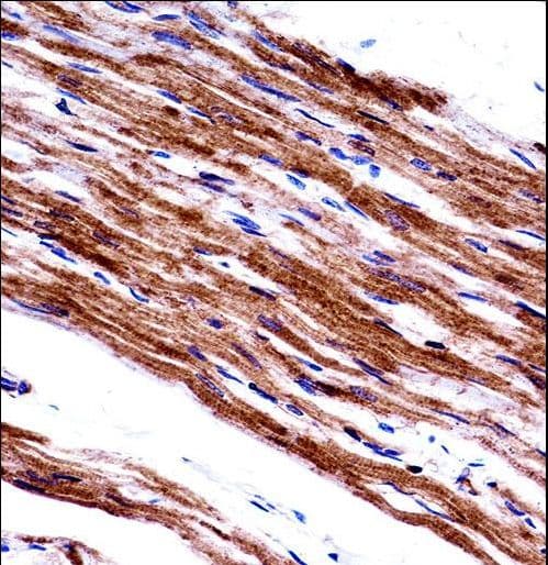 MLC2 / MYL9 Antibody (aa96-125)